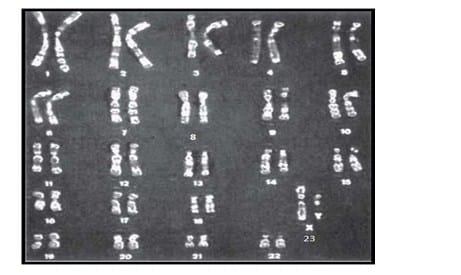 Penulisan formula kromosom pada kambing jantan yang mempunyai kromosom berjumlah 60 buah adalah